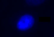 Figure 1: Live CHO-K1 cells transiently transfected with pSNAP-H2B