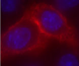 Figure 1:Live CHO-K1 cells transiently transfected with pCLIP-NK1R
