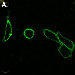 Figure 2: Live cell imaging of ACP-tag fusion proteins