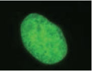 Figure 1: Live U-2 OS cells stably transfected with pSNAPf-H2B